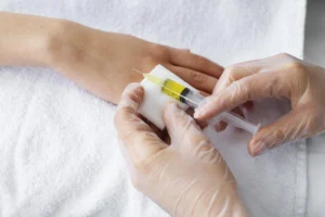 manfaat-suntik-vitamin-c-untuk-imunitas-dan-kulit